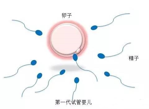 借卵代怀选性别